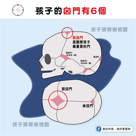 腦門位置|寶寶囟門不能摸？急診科醫師：摸囟門就知道孩子健康。